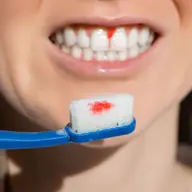 Lupta împotriva bolilor gingivale: prevenție și tratament