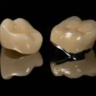 Îngrijirea corectă a coroanelor dentare din zirconiu: 3 sfaturi utile