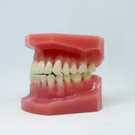 Retracția gingivală: cauze, efecte și tratamente posibile