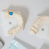 Ghid complet despre implanturile dentare moderne recomandat de Dr. Durbac