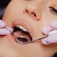 Ce opțiuni există pentru înlocuirea dinților lipsă, ghid Upgrade Dental