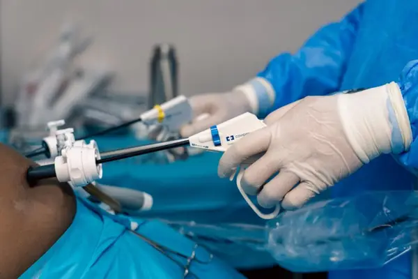 Chirurgia bariatrică în tratamentul diabetului de tip 2