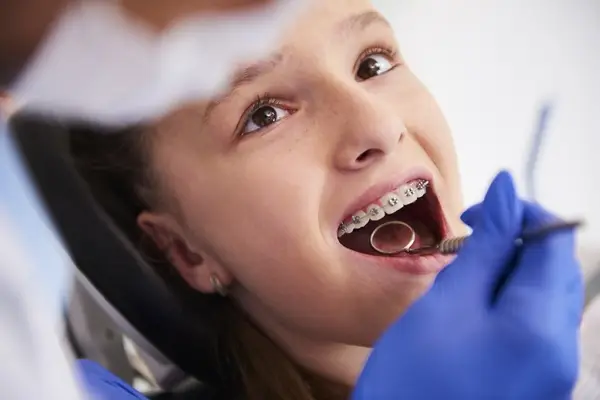 Beneficiile pe termen lung ale purtării unui aparat dentar