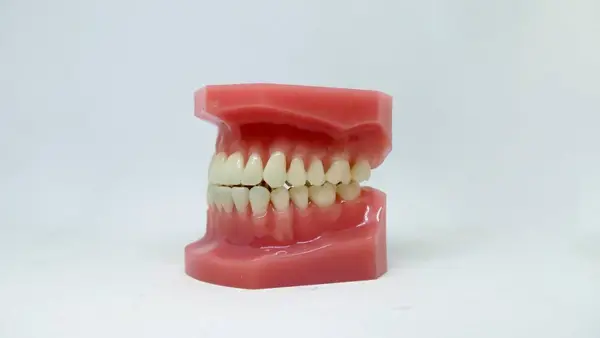 Retracția gingivală: cauze, efecte și tratamente posibile