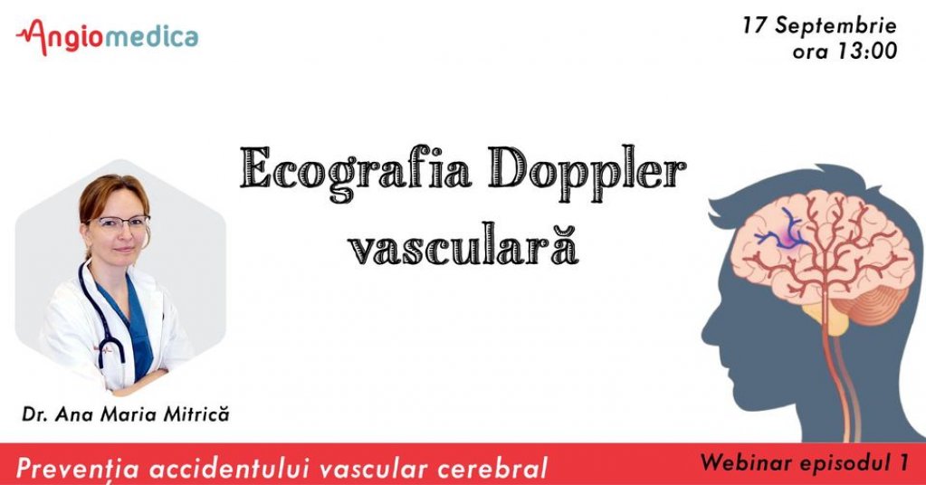 Ecografia Doppler vasculara