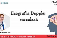 Ecografia Doppler vasculara