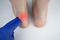Ruptura de tendon ahilean: opțiuni de tratament și recuperare pas cu pas
