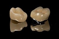 Îngrijirea corectă a coroanelor dentare din zirconiu: 3 sfaturi utile