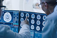 Depistarea problemelor neurologice: care sunt principalele investigații care pot fi recomandate de medic?