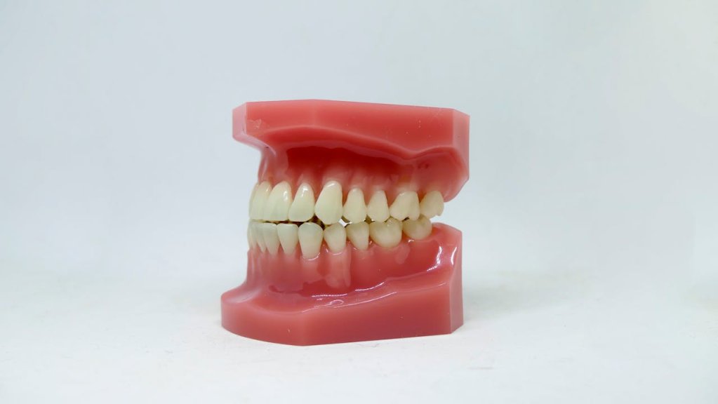Retracția gingivală: cauze, efecte și tratamente posibile
