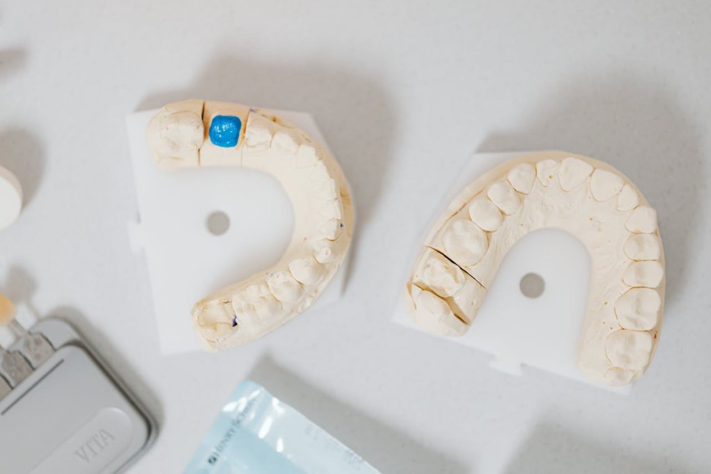 Ghid complet despre implanturile dentare moderne recomandat de Dr. Durbac