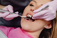 Cum asigură Angelescu Dental Clinic o experiență completă pentru pacienții care își doresc un zâmbet nou de la zero