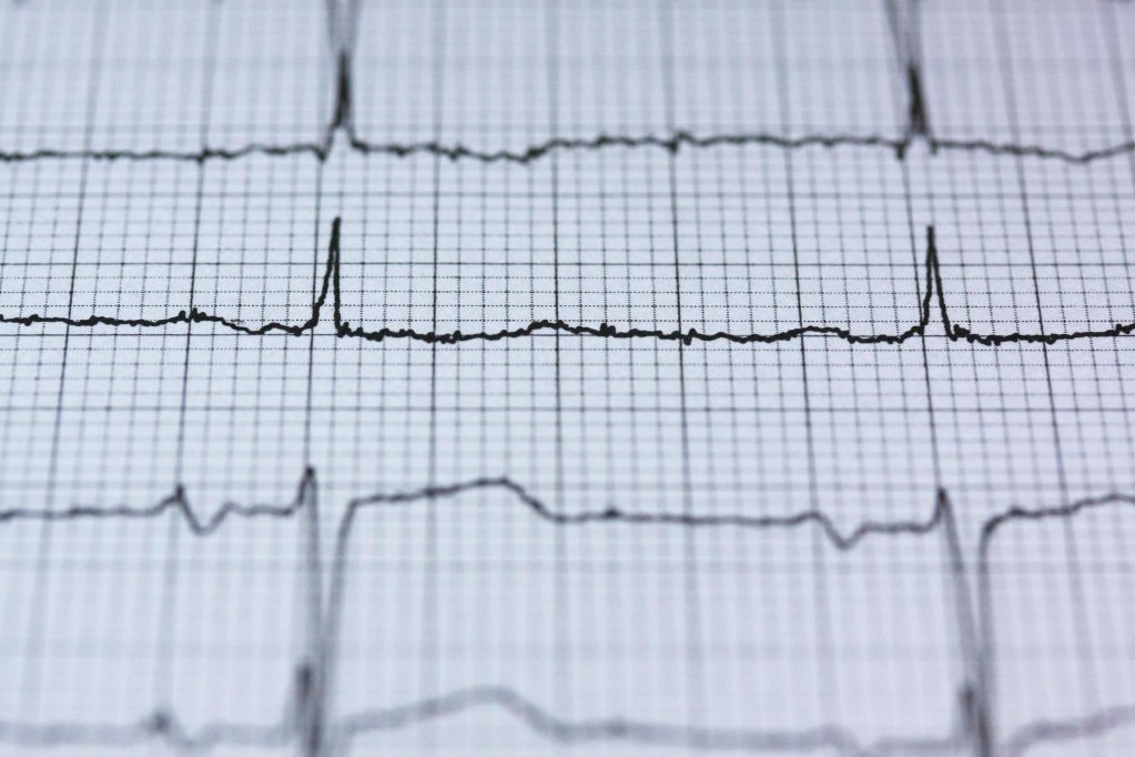 EKG, ecocardiografie sau Holter, de ce investigație cardiologică ai nevoie și când?