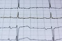EKG, ecocardiografie sau Holter, de ce investigație cardiologică ai nevoie și când?